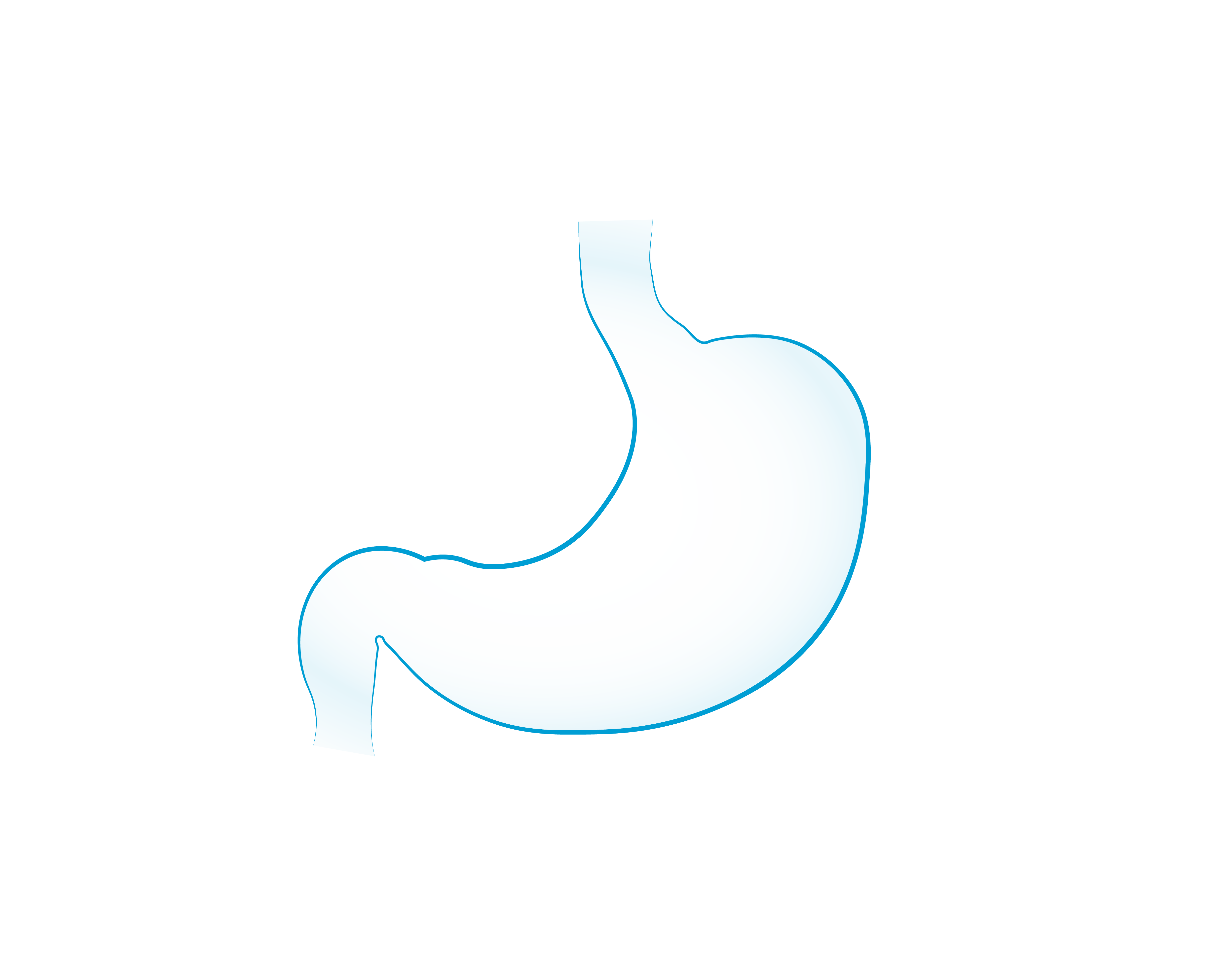 Il Tumore dello Stomaco