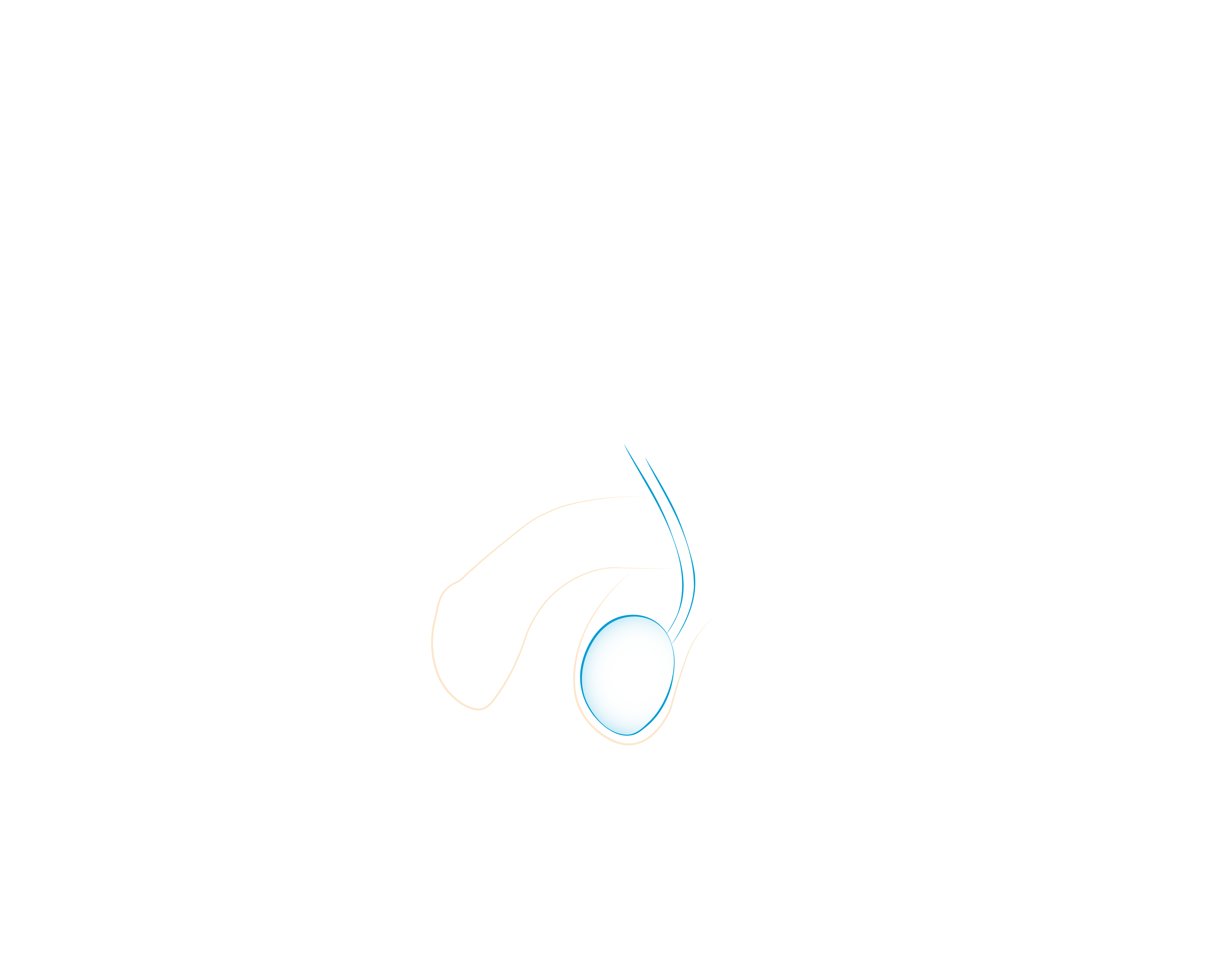 Il Tumore del Testicolo